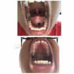 modèle_photos_dentition
